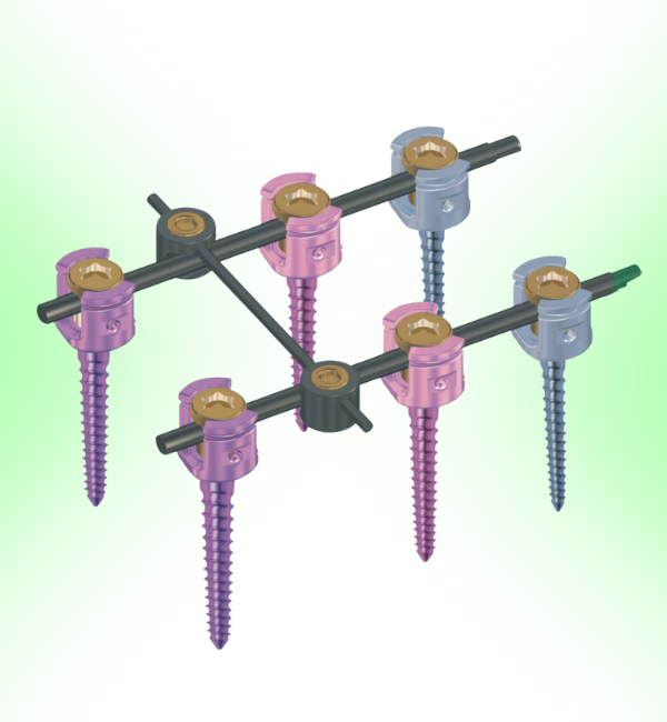 Spine Implant System