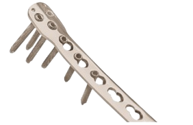 Locking Plate Anatomical Distal Tibia