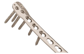 Locking Plate Anatomical Distal Tibia